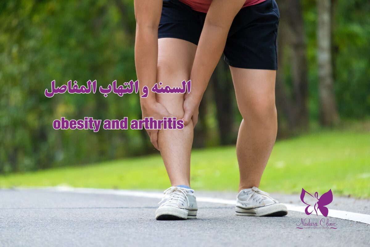 السمنة والتهاب المفاصل في الغردقة